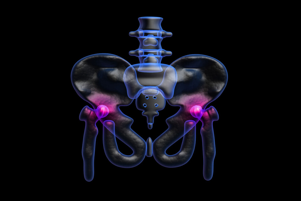 Nociceptiv innervasjon ved hoftesmerter