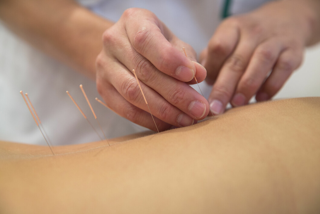 NFFs faggruppe for nålebehandling i fysioterapi støtter Dansk Selskab for Akupunktur i Fysioterapi, og ønsker også strengere regulering av nålebehandling i Norge.