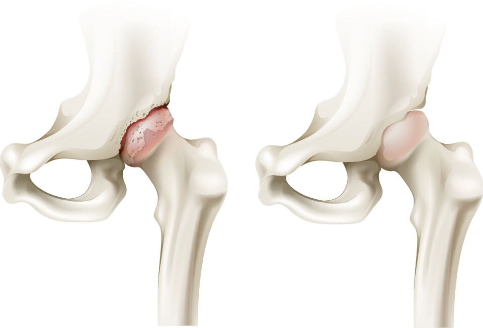 The effect of land-based exercise therapy in patients with osteoarthritis of the hip: a systematic review