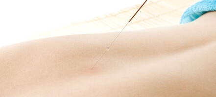 Akupunktur mot langvarige korsryggsmerter