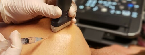 Management of Frozen Shoulder Using Corticosteroid Injection Therapy: An Evaluation of Current Practice among Physical Therapists Providing Injection Therapy in Norway