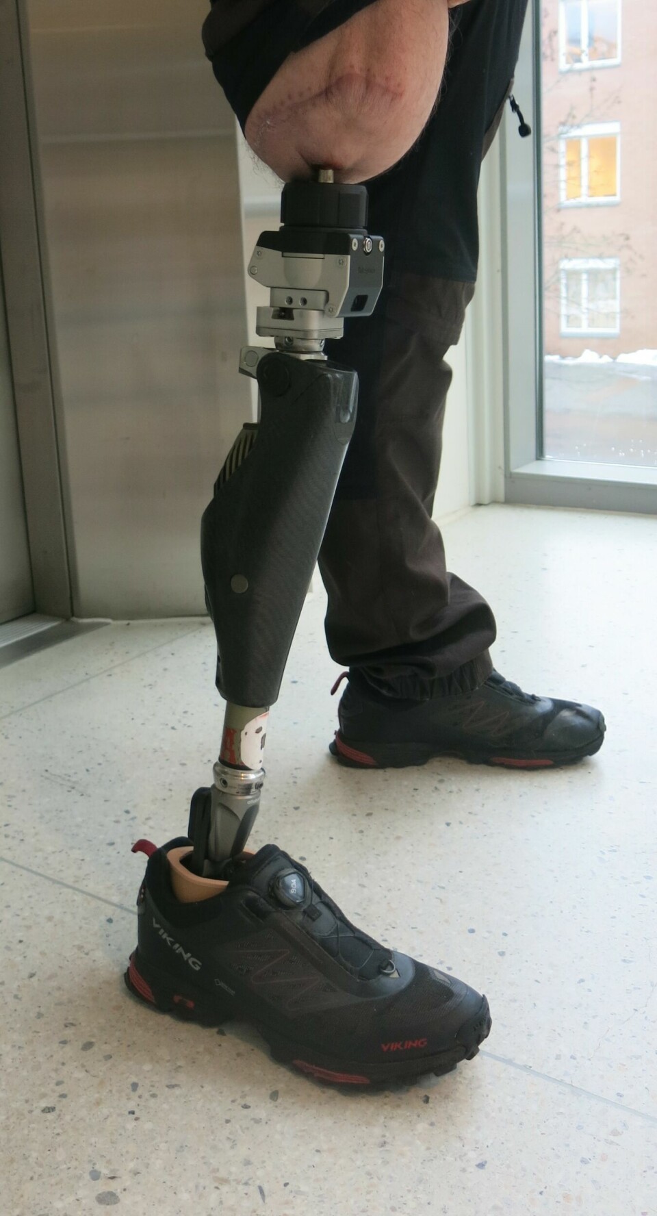 Pasient som har startet rehabilitering med 'langprotese'